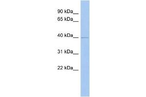 ZADH2 antibody used at 1 ug/ml to detect target protein. (ZADH2 Antikörper  (N-Term))