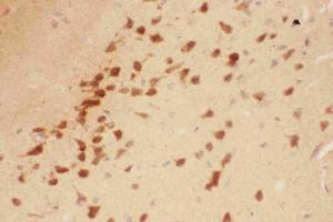 Immunohistochemistry (IHC) image for anti-Brain-Derived Neurotrophic Factor (BDNF) (AA 129-247) antibody (ABIN3043798)