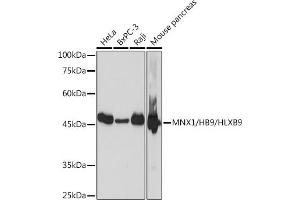 Western blot analysis of extracts of various cell lines, using MNX1/MNX1/HB9/HLXB9 Rabbit mAb (ABIN7268684) at 1:1000 dilution. (MNX1 Antikörper)