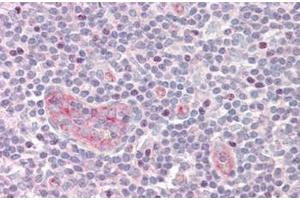 Immunohistochemistry (Paraffin-embedded Sections) (IHC (p)) image for anti-Upstream Binding Transcription Factor, RNA Polymerase I (UBTF) (Internal Region) antibody (ABIN1449688)