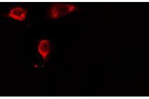 ABIN6275432 staining HeLa cells by IF/ICC. (RABEP2 Antikörper  (Internal Region))