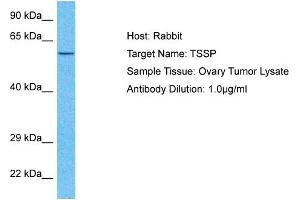 Host:  Rabbit  Target Name:  TSSP  Sample Type:  Ovary Tumor lysates  Antibody Dilution:  1. (PRSS16 Antikörper  (N-Term))