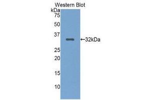 Western Blotting (WB) image for anti-Low Density Lipoprotein Receptor-Related Protein 5 (LRP5) (AA 769-1016) antibody (ABIN3204681) (LRP5 Antikörper  (AA 769-1016))