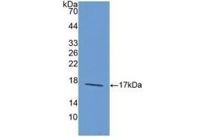 Detection of Recombinant LAMa1, Rat using Polyclonal Antibody to Laminin Alpha 1 (LAMA1) (Laminin alpha 1 Antikörper  (AA 1156-1276))