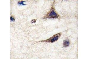 IHC analysis of FFPE human brain tissue stained with anti-TAU antibody