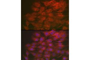 Immunofluorescence analysis of C6 cells using LML Rabbit pAb (ABIN7268204) at dilution of 1:250 (40x lens). (LMAN2L Antikörper)