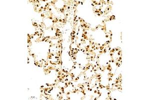 Immunohistochemistry of paraffin embedded rat lung using RB1 (ABIN7075477) at dilution of 1:700 (400x lens) (RBM45 Antikörper)