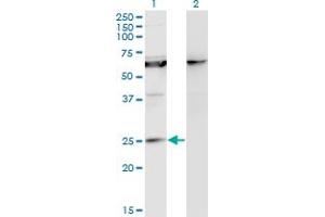 Western Blot analysis of KCNIP1 expression in transfected 293T cell line by KCNIP1 monoclonal antibody (M10), clone 3D9. (KCNIP1 Antikörper  (AA 1-216))