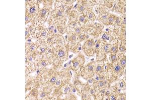 Immunohistochemistry of paraffin-embedded human liver injury using ST3GAL3 antibody (ABIN5974085) at dilution of 1/100 (40x lens). (ST3GAL3 Antikörper)