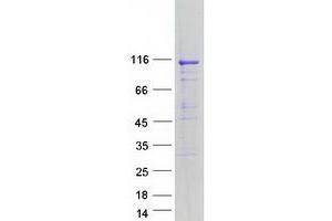 Validation with Western Blot (ATP2A1/SERCA1 Protein (Transcript Variant A) (Myc-DYKDDDDK Tag))