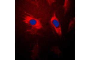 Immunofluorescent analysis of 14-3-3 theta staining in HeLa cells. (14-3-3 theta Antikörper  (Center))