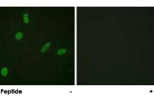 Immunofluorescence analysis of HeLa cells, using ETS1 polyclonal antibody .
