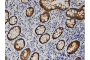 Image no. 1 for anti-Patatin-Like phospholipase Domain Containing 6 (PNPLA6) (AA 1229-1328) antibody (ABIN599523) (PNPLA6 Antikörper  (AA 1229-1328))