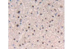 Immunohistochemistry (IHC) image for anti-Methyl CpG Binding Protein 2 (MECP2) (AA 1-177) antibody (ABIN1869144)