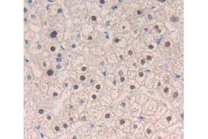 Used in DAB staining on fromalin fixed paraffin- embedded liver tissue (MECP2 Antikörper  (AA 1-177))
