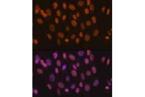 Immunofluorescence analysis of NIH-3T3 cells using SM/SM/SNF2H Rabbit mAb (ABIN7270656) at dilution of 1:100 (40x lens). (SMARCA5 Antikörper)