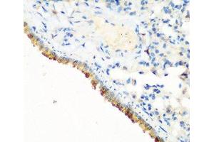 Immunohistochemistry of paraffin-embedded Mouse lung using CBL Polyclonal Antibody at dilution of 1:200 (40x lens). (CBL Antikörper)