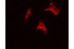 ABIN6267366 staining Hela cells by IF/ICC. (BCR Antikörper  (pTyr177))