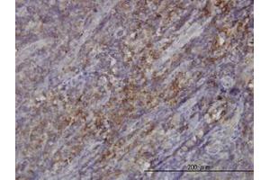 Image no. 1 for anti-RAS Guanyl Releasing Protein 4 (RASGRP4) (AA 574-674) antibody (ABIN599321) (RASGRP4 Antikörper  (AA 574-674))