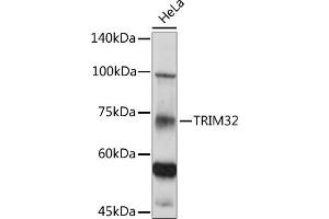 Western blot analysis of extracts of HeLa cells, using TRIM32 antibody (ABIN6132735, ABIN6149520, ABIN6149521 and ABIN6222878) at 1:500 dilution. (TRIM32 Antikörper  (AA 1-280))