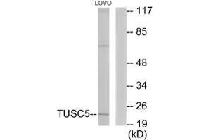 Western blot analysis of extracts from LOVO cells, using TUSC5 antibody. (TUSC5 Antikörper)