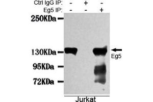 Immunoprecipitation analysis of Jurkat cell lysates using Eg5 mouse mAb. (KIF11 Antikörper)