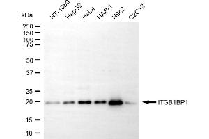 Western blotting analysis using ITGB1BP1 antibody (ABIN7799068). (ITGB1BP1 Antikörper)