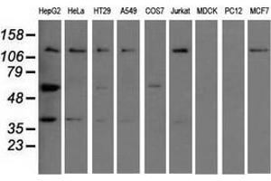 Western blot analysis of extracts (35 µg) from 9 different cell lines by using anti-IGF2BP2 monoclonal antibody.