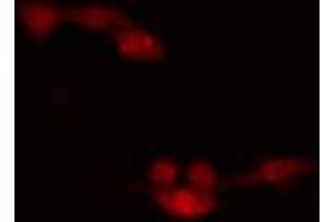 ABIN6266648 staining HeLa cells by IF/ICC. (CDK7 Antikörper  (Internal Region))