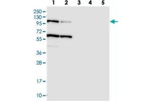 Western blot analysis of Lane 1: RT-4, Lane 2: U-251 MG, Lane 3: Human Plasma, Lane 4: Liver, Lane 5: Tonsil with USP6NL polyclonal antibody . (USP6NL Antikörper)