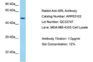 Western Blotting (WB) image for anti-Sarcalumenin (SRL) (C-Term) antibody (ABIN2789371)