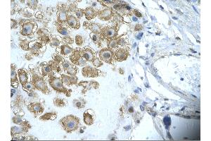 Rabbit Anti-ENO1 Antibody       Paraffin Embedded Tissue:  Human placenta cell   Cellular Data:  Epithelial cells of renal tubule  Antibody Concentration:   4. (ENO1 Antikörper  (Middle Region))