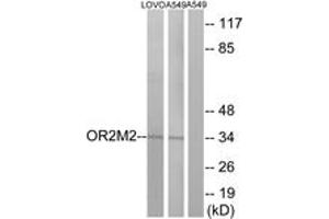Western blot analysis of extracts from LOVO/A549 cells, using OR2M2 Antibody. (OR2M2 Antikörper  (AA 281-330))