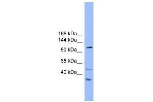 Western Blot showing STARD8 antibody used at a concentration of 1. (STARD8 Antikörper  (N-Term))