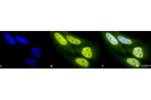 Immunocytochemistry/Immunofluorescence analysis using Rabbit Anti-Acetylated Lysine Polyclonal Antibody . (Lysine (lys) (acetylated) Antikörper (PerCP))