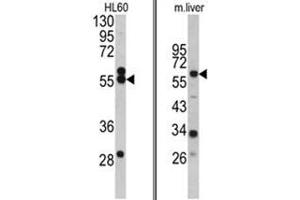 (LEFT) Western blot analysis of HMGCS1 antibody (Center) in HL60 cell line lysates (35ug/lane). (HMGCS1 Antikörper  (Middle Region))