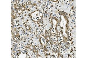 IHC analysis of ME2 using anti-ME2 antibody (ABIN7600967). (NAD-ME Antikörper  (AA 26-584))