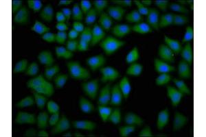 Immunofluorescence staining of Hela cells with ABIN7149364 at 1:133, counter-stained with DAPI. (CKAP4 Antikörper  (AA 260-394))
