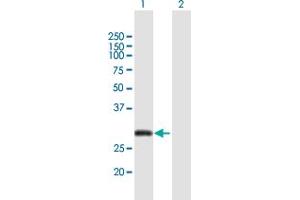 Western Blot analysis of CITED2 expression in transfected 293T cell line by CITED2 MaxPab polyclonal antibody. (CITED2 Antikörper  (AA 1-270))