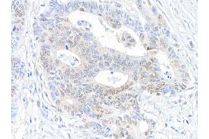 anti-RAN Binding Protein 1 (RANBP1) (AA 1-50) antibody