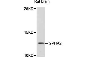 Western blot analysis of extracts of rat brain cells, using GPHA2 antibody. (GPHa2 Antikörper)