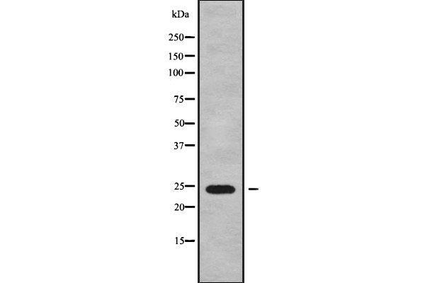 MRPS26 antibody  (Internal Region)