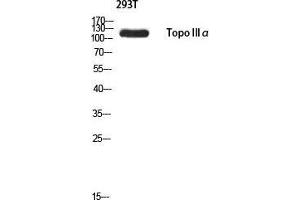 Western Blot (WB) analysis of 293T using Topo IIIalpha antibody. (TOP3A Antikörper)