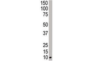 Western blot analysis of NEDD8 antibody and HeLa cell lysate (NEDD8 Antikörper  (AA 1-32))