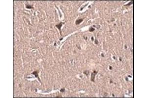 Immunohistochemistry of MIPU1 in human brain tissue with this product at 2. (ZNF667 Antikörper  (N-Term))