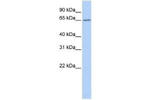 WB Suggested Anti-ACOT12 Antibody Titration: 0. (ACOT12 Antikörper  (Middle Region))