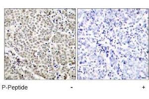 Image no. 1 for anti-Nuclear Factor-kB p65 (NFkBP65) (pSer529) antibody (ABIN196954) (NF-kB p65 Antikörper  (pSer529))