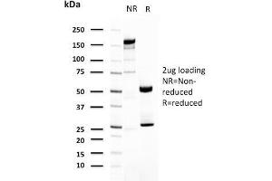 SDS-PAGE Analysis Purified Uroplakin 1A Mouse Monoclonal Antibody (UPK1A/2921). (UPK1A Antikörper  (AA 114-173))