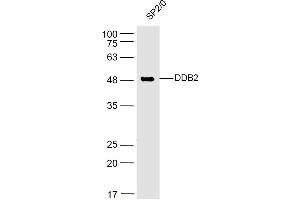 SP2/0 lysates probed with DDB2 Polyclonal Antibody, Unconjugated  at 1:500 dilution and 4˚C overnight incubation. (DDB2 Antikörper  (AA 201-300))