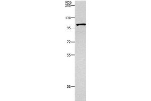 Western Blot analysis of 231 cell using TNK2 Polyclonal Antibody at dilution of 1:1800 (TNK2 Antikörper)